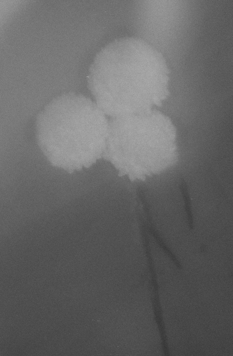 flowers trio crop 3
